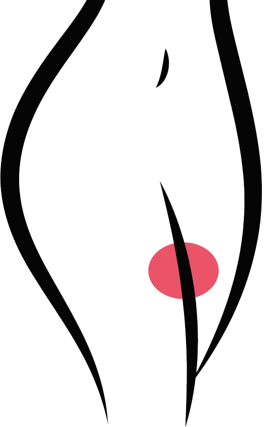 Image 1 anti chafing thigh bands